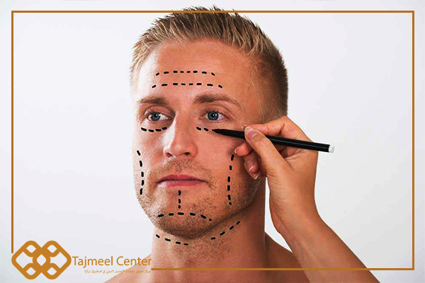 Types of facial plastic surgery