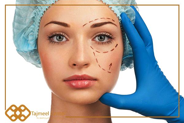 Types of facial plastic surgery plastische gesichtschirurgie Types de chirurgie plastique du visage