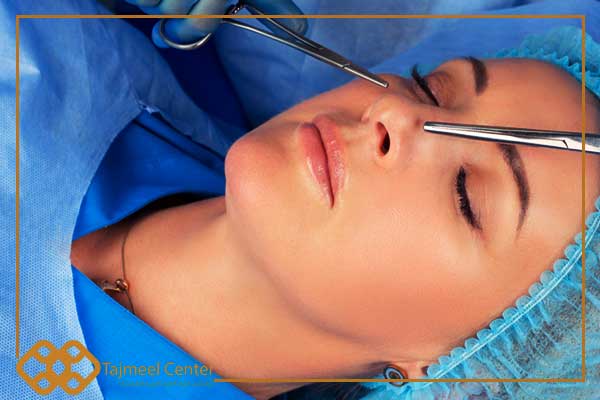 Chirurgia della cartilagine nasale