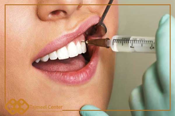 aerosol anestésico dental