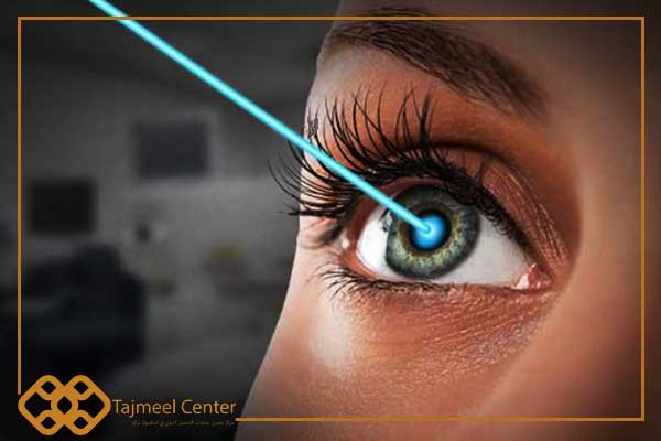 Le coût de la chirurgie des yeux au laser en Turquie