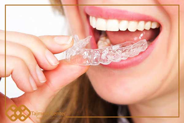 Les bagues transparentes traitent-elles les dents qui poussent ?