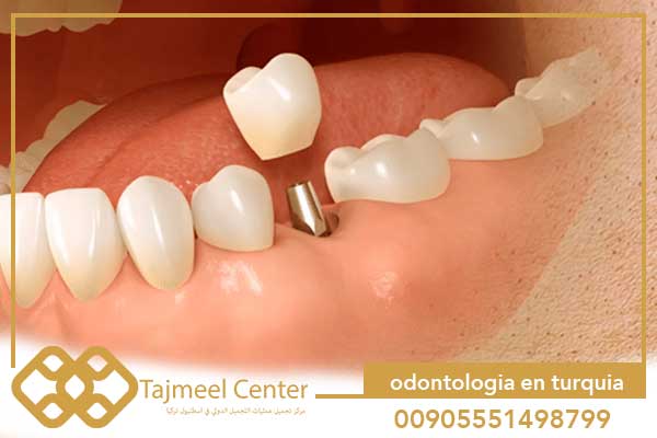 odontologia en turquia