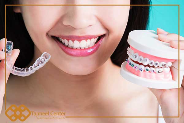 Types of orthodontics