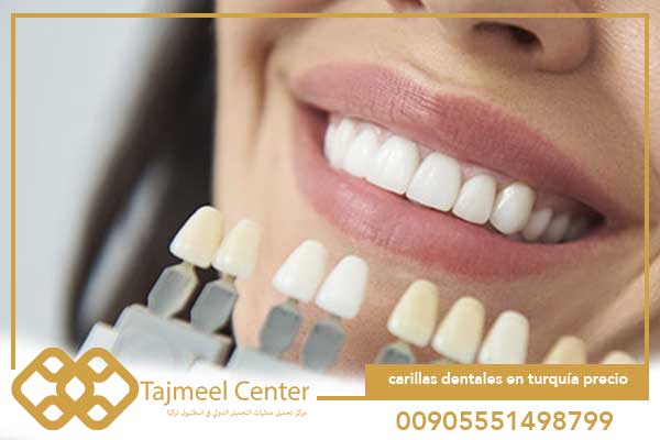 carillas dentales en turquía precio