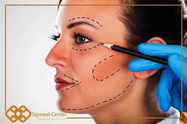 cost of facelift surgery in Turkey