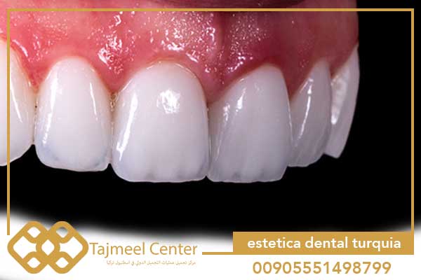 estetica dental turquia