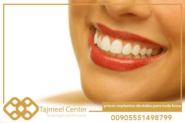 precio implantes dentales para toda boca turquía