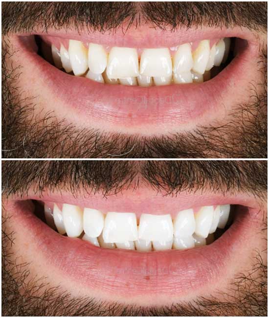 کلینیک دندانپزشکی استانبول ترکیه