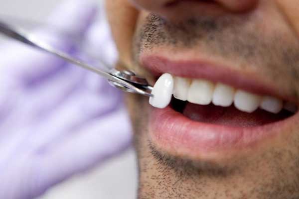 Turismo Dental en Turquía: 12 Razones para Elegir este Destino para Tratamientos Dentales
