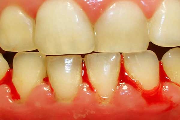 чистка зубов стамбул: Забота о вашей улыбке
