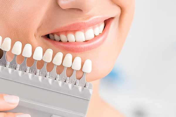 Ventajas del Tratamiento Dental
