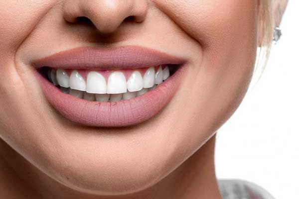تيجان البورسلين الانواع والمقارانات: الحل المثالي للأسنان الجميلة والقوية