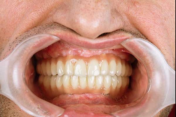 стоматология в стамбуле цены : Ваш путь к качественным стоматологическим решениям