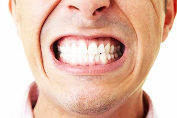 صرير الأسنان: الأسباب والتأثيرات و15 نصيحة للتعامل معه
