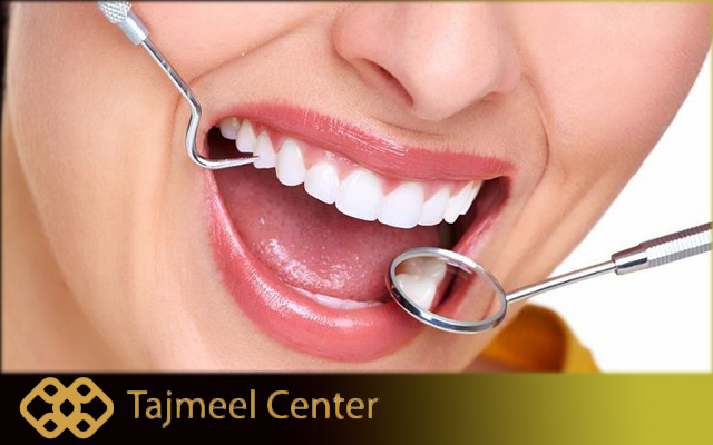 Composite Bonding vs Veneers in Turkey