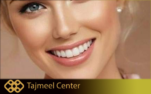 How Long Do Veneers from Turkey Last 2026: The Complete Medical Guide on Durability & Care