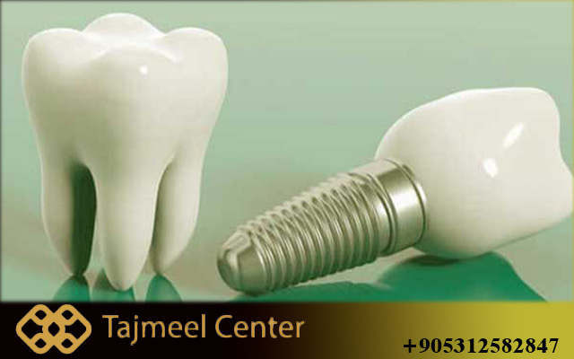 Best time of year to visit Turkey for dental work